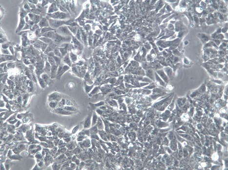 HCT-8[HRT-18]人结肠癌细胞【已通过STR鉴定】