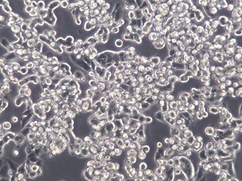 SUIT-2;人胰腺癌细胞【已通过STR鉴定】