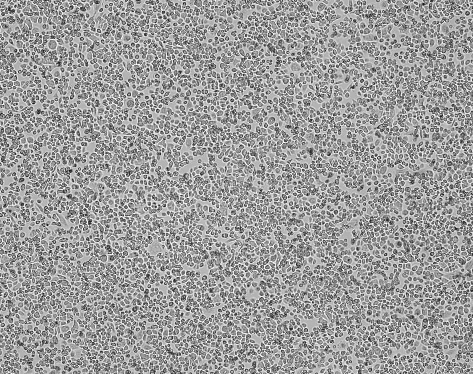 细胞攻略 | AsPC-1(人转移胰腺腺癌细胞)培养教程