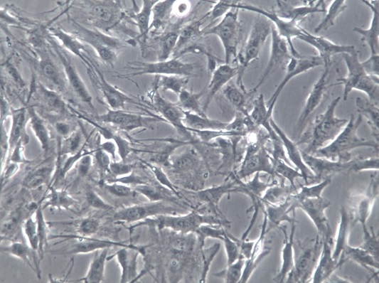 NCI-H2452人间皮瘤细胞【已通过STR鉴定】