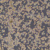 人胃癌奥沙利铂耐药株 MKN-45/Oxaliplatin