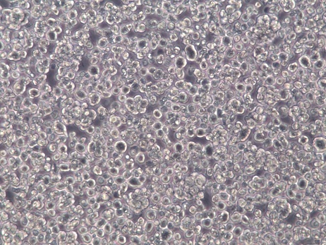 LP-1;人多发性骨髓瘤细胞【已通过STR鉴定】