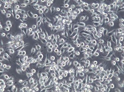 NCI-H2122人肺癌细胞【已通过STR鉴定】