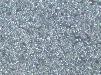 NU-DUL-1;人弥漫性B细胞淋巴瘤细胞【已通过STR鉴定】