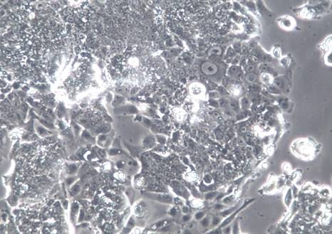 CL-11人结肠癌细胞【已通过STR鉴定】