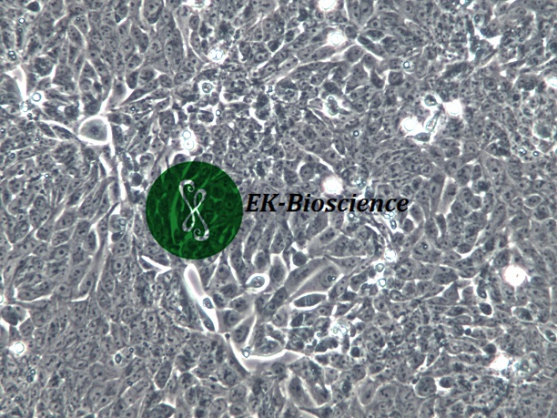 DLD-1人结直肠腺癌上皮细胞【已通过STR鉴定】
