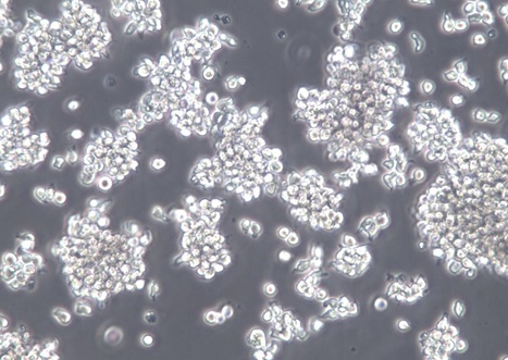 SUP-T1;人T淋巴母细胞瘤细胞【已通过STR鉴定】