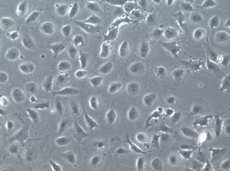 NP69;人鼻咽上皮细胞【已通过STR鉴定】