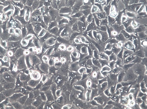 SW780人膀胱移行细胞癌【已通过STR鉴定】