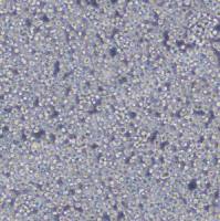 人急性T淋巴细胞白血病细胞;Jurkat (STR)