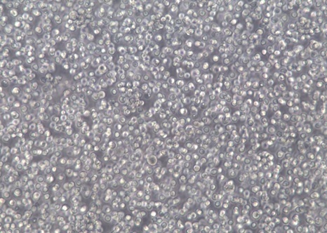 REC-1;人非霍奇金淋巴瘤细胞【已通过STR鉴定】