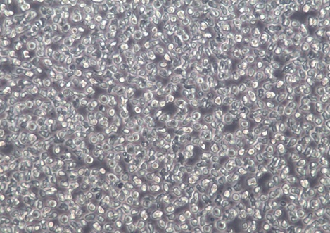 Mino人套细胞淋巴瘤细胞【已通过STR鉴定】