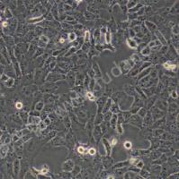 人非小细胞肺癌细胞;NCI-H1299 (STR)