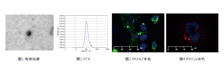 外泌体染色-PKH67或PKH26染色