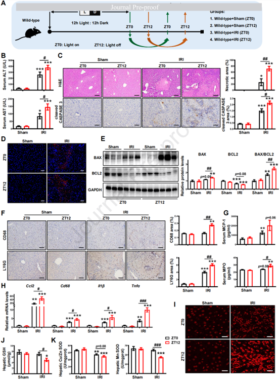 J Hepatol丨治疗时机很重要！揭秘生物钟调控肝脏缺血再灌注新机制