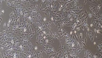 猪原代肺微血管内皮细胞性能特点