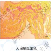 天狼猩红染色