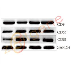 外泌体鉴定-WB