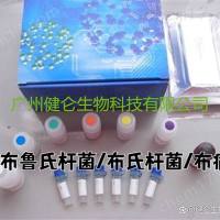 布病BRUCELLA-IgM抗体检测试剂盒(ELISA捕获法)