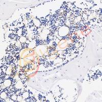 骨组织脱钙(慢脱)