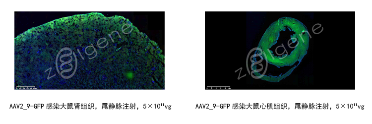 过表达腺相关病毒包装