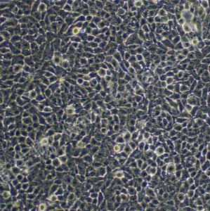 高转移人肝癌细胞;MHCC97-H (STR)