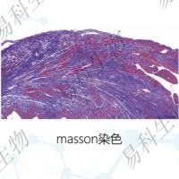 Masson染色