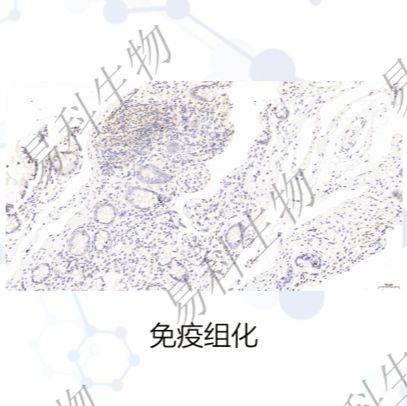 免疫组化
