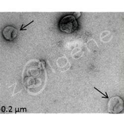 外泌体鉴定-电镜
