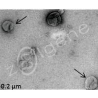 外泌体鉴定-电镜