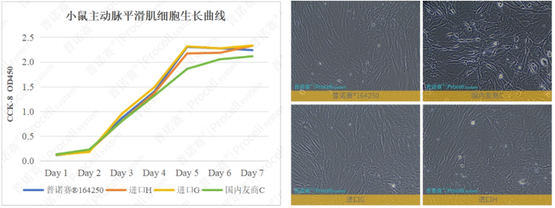 普诺赛®特级胎牛血清（澳洲）（货号：164250）在小鼠主动脉平滑肌细胞培养中展现出显著的促增殖效果