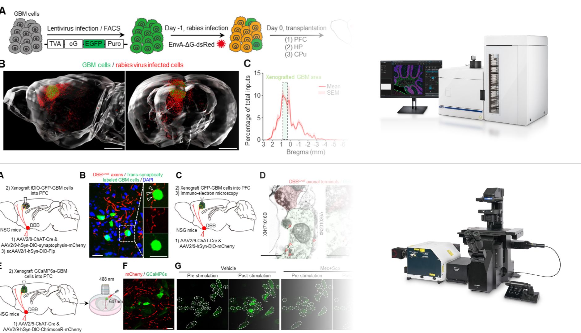 科技前沿丨卞修武/冯华团队合作解析远距离胆碱能输入对GBM进展的影响