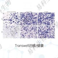 Transwell迁移