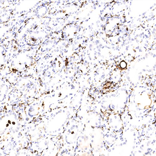 免疫组化 （IHC）白光拍照