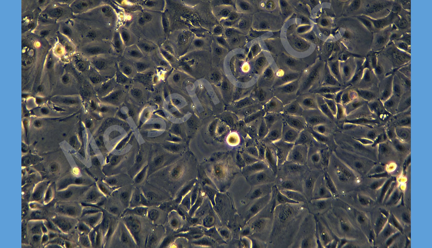 【细胞推荐】人肺癌细胞 NCI-H3255