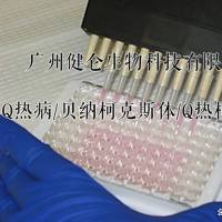 Q热病/伯氏立克次氏体/柯克斯体IgM抗体检测试剂盒（酶免法）