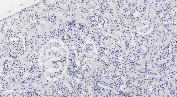 免疫组化（不含一抗）