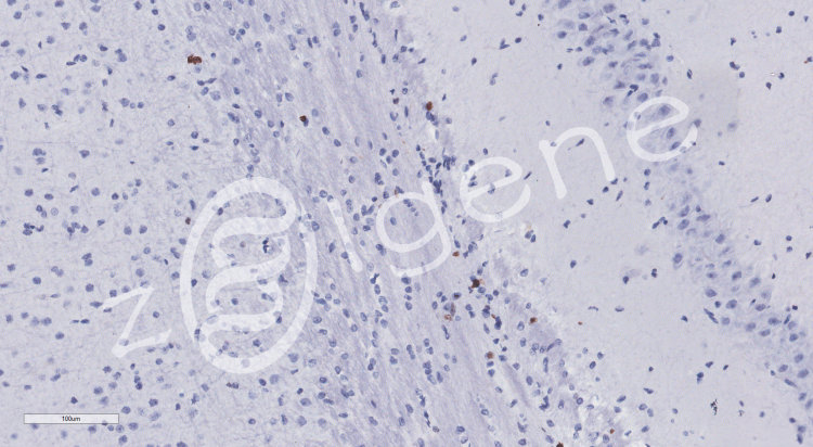 免疫组化（不含一抗）