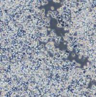 大鼠肾上腺嗜铬细胞瘤细胞(未分化);PC-12(未分化)