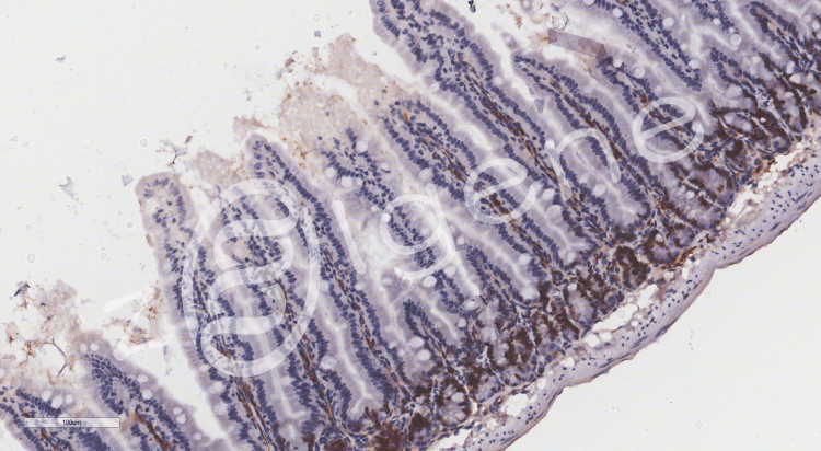 免疫组化（不含一抗）
