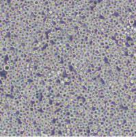 人慢性髓系白血病细胞;K562 (STR)