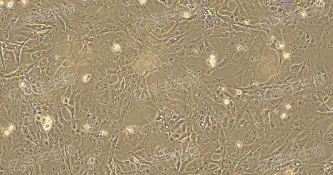 【实验警报】劣质血清=隐形杀手！你实验失败的元凶找到了？