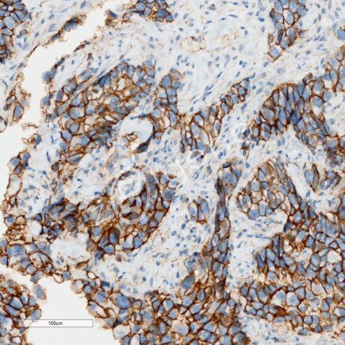 免疫组化（不含一抗）