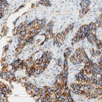 免疫组化（不含一抗）