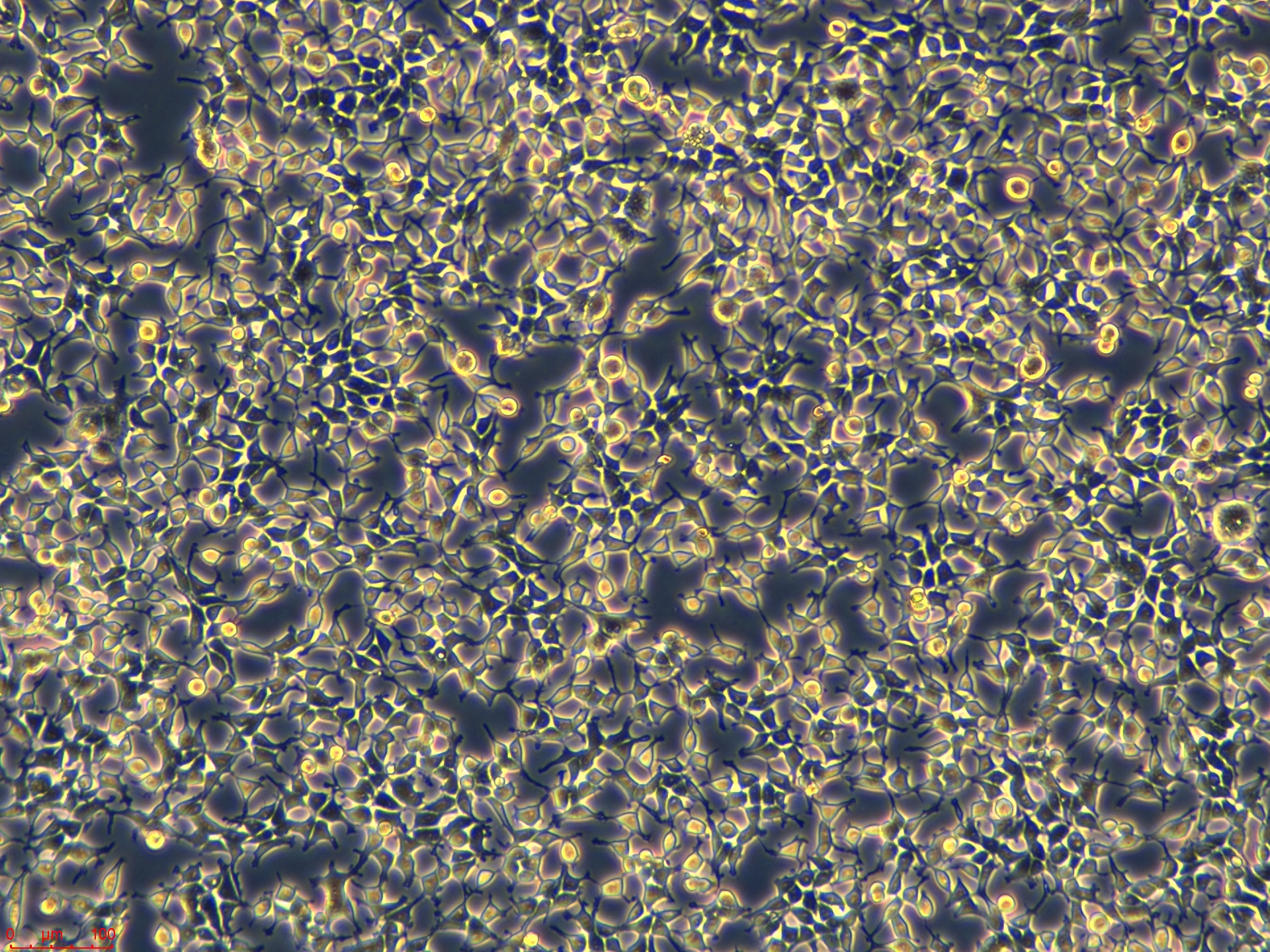 【每日推荐】美森细胞-人胚胎肾细胞系 293T