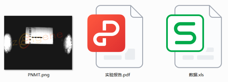 蛋白免疫印迹实验（WB）