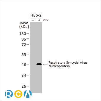 2025年末狂欢大放送，购买GeneTex抗体、京东礼品卡送给您