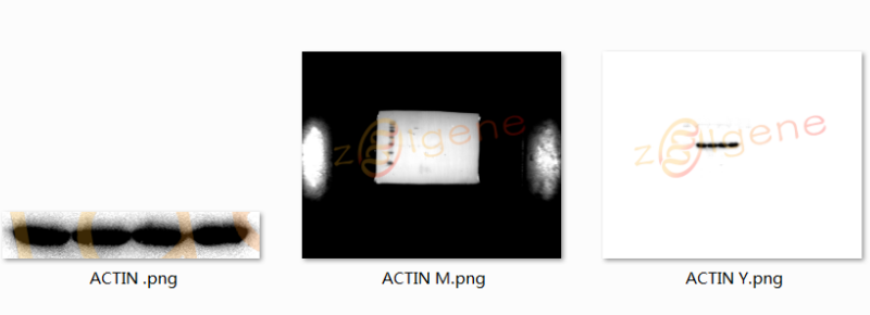 蛋白免疫印迹实验（WB）