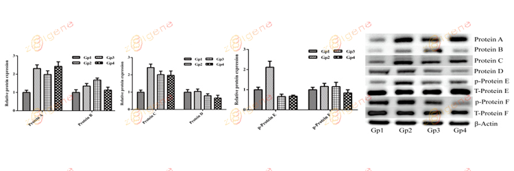 蛋白免疫印迹实验（WB）