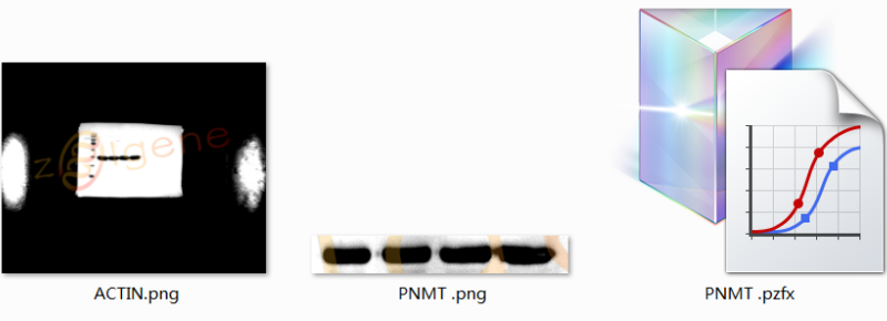 蛋白免疫印迹实验（WB）
